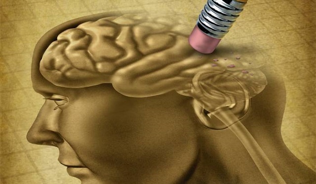 ¿Qué tipo de personalidad tiene más riesgo de padecer Alzheimer? - Medciencia